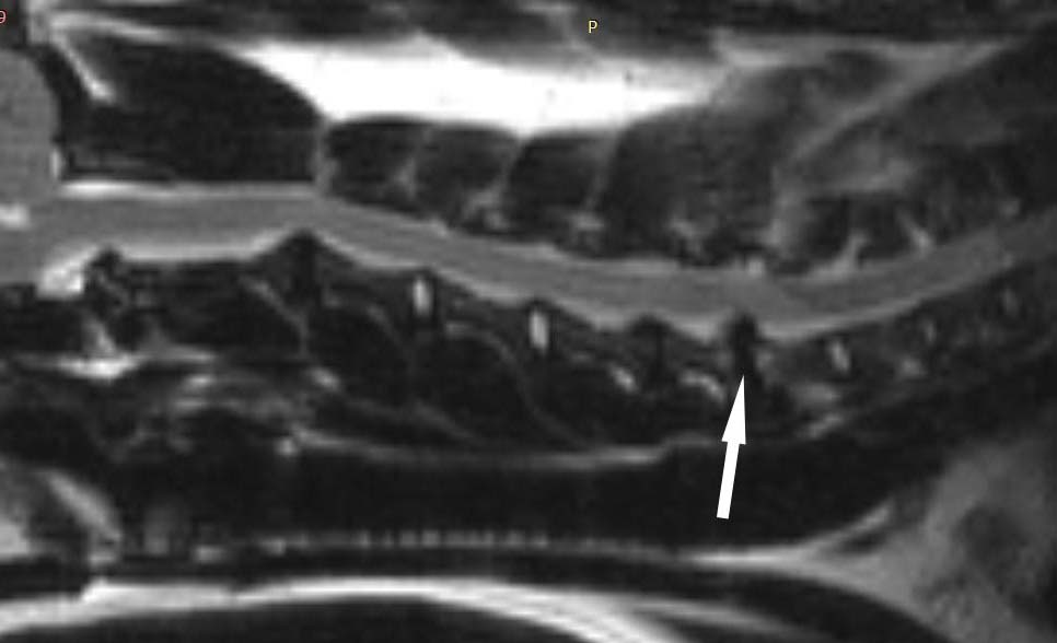 Экструзия дисков шейного отдела позвоночника. Грыжа межпозвоночного диска у собаки. Протрузия на рентгене. Межпозвоночная грыжа у собак рентген. Грыжа экструзия протрузия у собак.